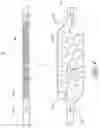 Fig. 11 - Systems and methods for treating a hollow anatomical structure