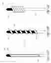 Fig. 16 - Systems and methods for treating a hollow anatomical structure
