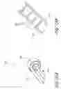 Fig. 17 - Systems and methods for treating a hollow anatomical structure