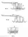 Fig. 08 - Insert for implantable electrode