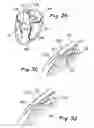 Fig. 04 - Devices and methods for transluminal or transthoracic interstitial electrode placement