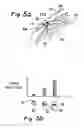 Fig. 06 - Devices and methods for transluminal or transthoracic interstitial electrode placement