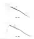 Fig. 05 - Indirect-release electrolytic implant delivery systems