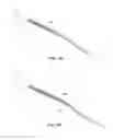 Fig. 07 - Indirect-release electrolytic implant delivery systems