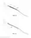 Fig. 09 - Indirect-release electrolytic implant delivery systems