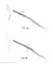 Fig. 07 - Indirect-release electrolytic implant delivery systems