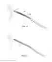 Fig. 09 - Indirect-release electrolytic implant delivery systems