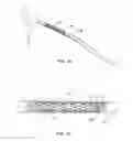 Fig. 10 - Indirect-release electrolytic implant delivery systems