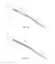 Fig. 06 - Pass-through restraint electrolytic implant delivery systems