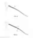Fig. 07 - Pass-through restraint electrolytic implant delivery systems
