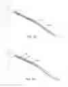 Fig. 08 - Pass-through restraint electrolytic implant delivery systems