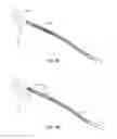 Fig. 06 - Guided stent delivery systems of minimal diameter