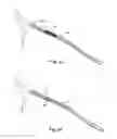 Fig. 08 - Guided stent delivery systems of minimal diameter