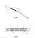 Fig. 09 - Guided stent delivery systems of minimal diameter