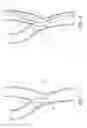 Fig. 03 - Noncylindrical stent deployment system for treating vascular bifurcations