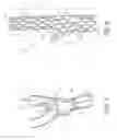Fig. 05 - Noncylindrical stent deployment system for treating vascular bifurcations