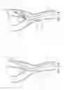 Fig. 13 - Noncylindrical stent deployment system for treating vascular bifurcations