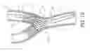Fig. 15 - Noncylindrical stent deployment system for treating vascular bifurcations