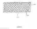 Fig. 03 - Medical device