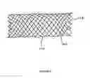 Fig. 03 - Medical device
