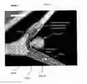 Fig. 08 - Medical device