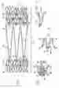 Fig. 03 - Intravascular stent and method of use