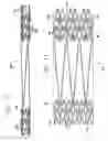 Fig. 06 - Intravascular stent and method of use