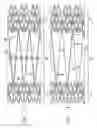 Fig. 07 - Intravascular stent and method of use
