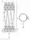 Fig. 08 - Intravascular stent and method of use