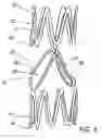 Fig. 04 - Artificial prostheses with preferred geometries