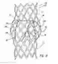 Fig. 05 - Artificial prostheses with preferred geometries