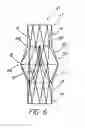 Fig. 07 - Artificial prostheses with preferred geometries