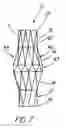 Fig. 08 - Artificial prostheses with preferred geometries