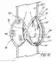 Fig. 09 - Artificial prostheses with preferred geometries