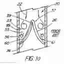Fig. 11 - Artificial prostheses with preferred geometries