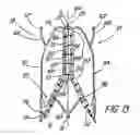 Fig. 14 - Artificial prostheses with preferred geometries