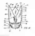Fig. 15 - Artificial prostheses with preferred geometries