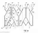 Fig. 17 - Artificial prostheses with preferred geometries