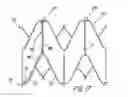 Fig. 18 - Artificial prostheses with preferred geometries