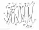 Fig. 19 - Artificial prostheses with preferred geometries