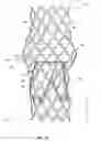 Fig. 24 - Artificial prostheses with preferred geometries
