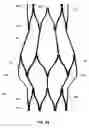 Fig. 26 - Artificial prostheses with preferred geometries
