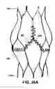 Fig. 27 - Artificial prostheses with preferred geometries