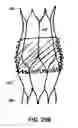 Fig. 28 - Artificial prostheses with preferred geometries