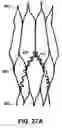 Fig. 29 - Artificial prostheses with preferred geometries
