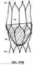 Fig. 30 - Artificial prostheses with preferred geometries