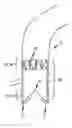 Fig. 01 - Device for the implantation and fixation of prosthetic valves