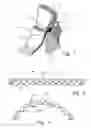 Fig. 02 - Device and method for treatment of mitral insufficiency