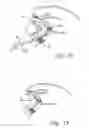 Fig. 06 - Device and method for treatment of mitral insufficiency