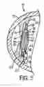 Fig. 05 - Intraocular lens adapted for accommodation via electrical signals